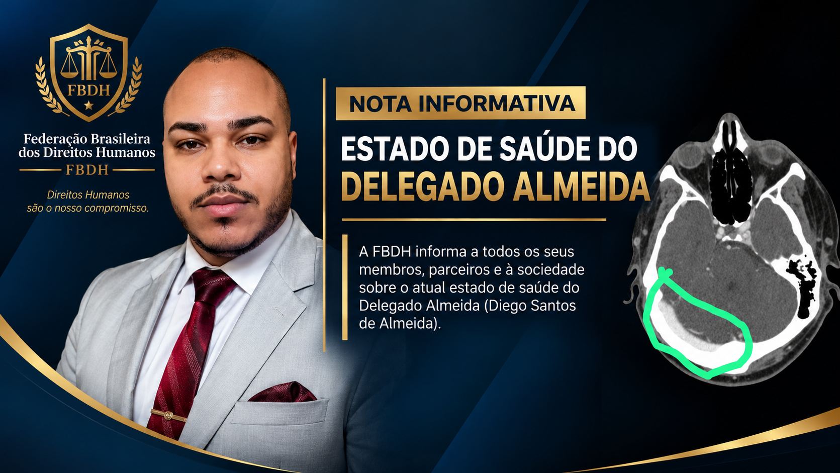 Nota informativa sobre o estado de saúde do Delegado Almeida